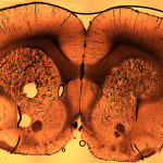 Rat brain frontal plane slice (photo). 