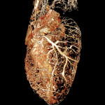 Rat Heart Perfused with BriteVu CT Contrast Agent