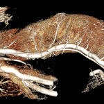 An alligator was perfused via the ventral coelomic (abdominal) vein with BriteVu.