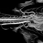 Alligator heart and neck (whole body) BriteVu contrast arteriovenogram.